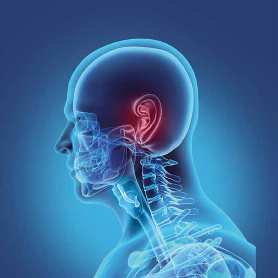 Anatomical rendering of the head and neck highlighting the middle ear, the target of the “ONE SHOT” stapedotomy technique