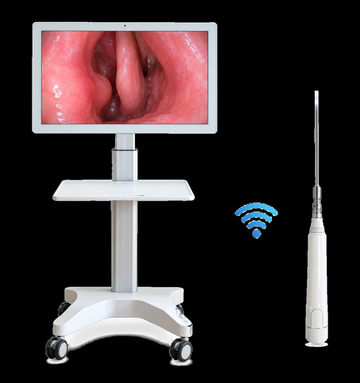 FreeView wireless ENT endoscope streaming a live nasal endoscopy view to the 18-inch Android display on its mobile cart